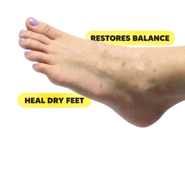 Onyx Brands Foot Callus Remover Treatment-5